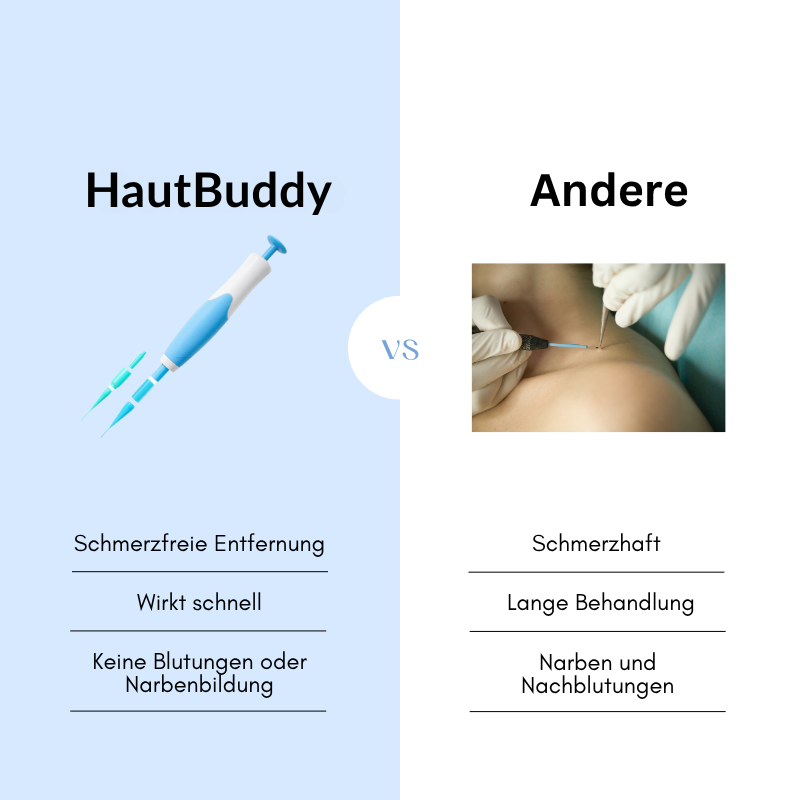 HautBuddy